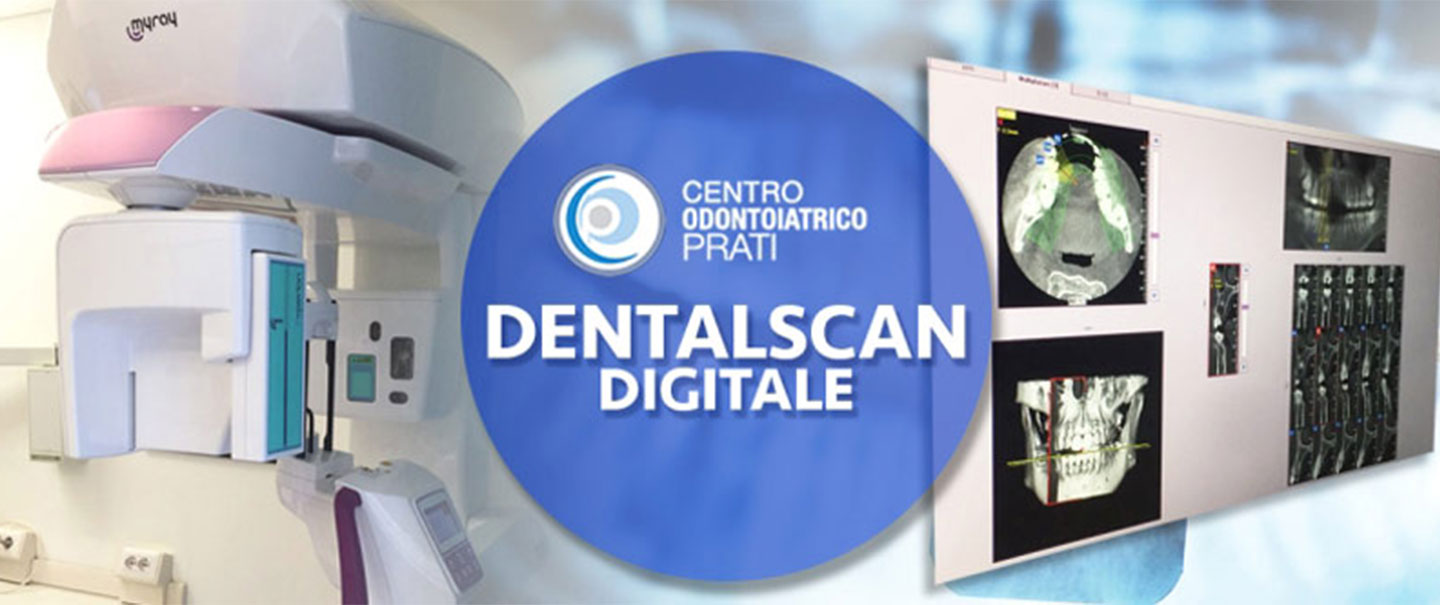 Dentalscan